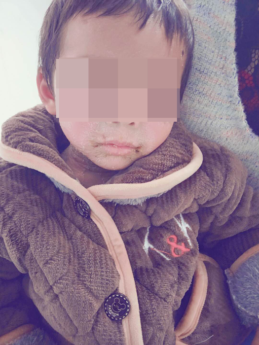 一例4s综合征患儿上蔡协和儿科治愈出院